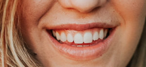 diastema